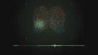 A front view of a brain drawn as coloured points joined by faint lines, with a cluster on the lower left lit in green, above a horizontal track marked with six green windows and a white cursor inside the fourth.